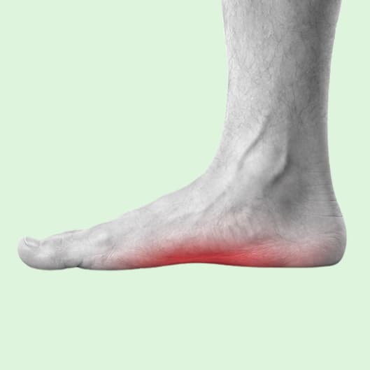 Side view of a foot with the arch and sole highlighted.