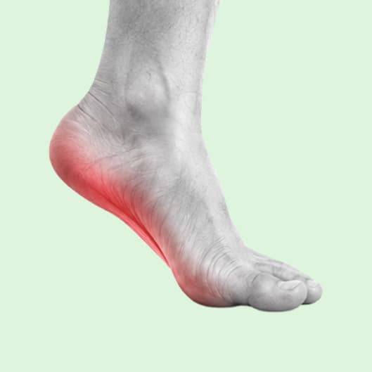 Foot illustration highlighting the heel and underside of the arch.